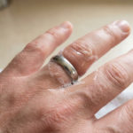 Retirer bague doigt gonflé : comment l'enlever sans douleur 4 Close-up of a hand with a silver ring stuck on a swollen finger. White soap foam surrounds the ring, indicating a gentle removal attempt.